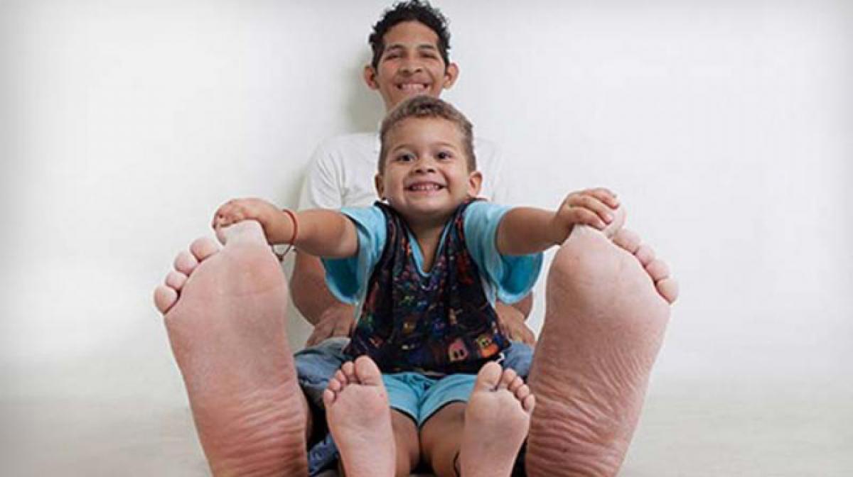 Meet Venezuelas tallest man with worlds largest feet